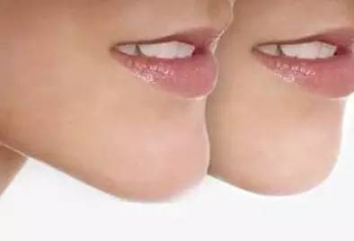 如何拥有一个好看的下巴,怎样拥有方下巴