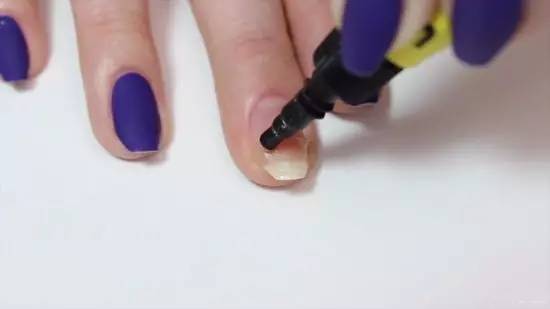 指甲从根部断裂去除断甲,指甲断裂在家自己怎么修补