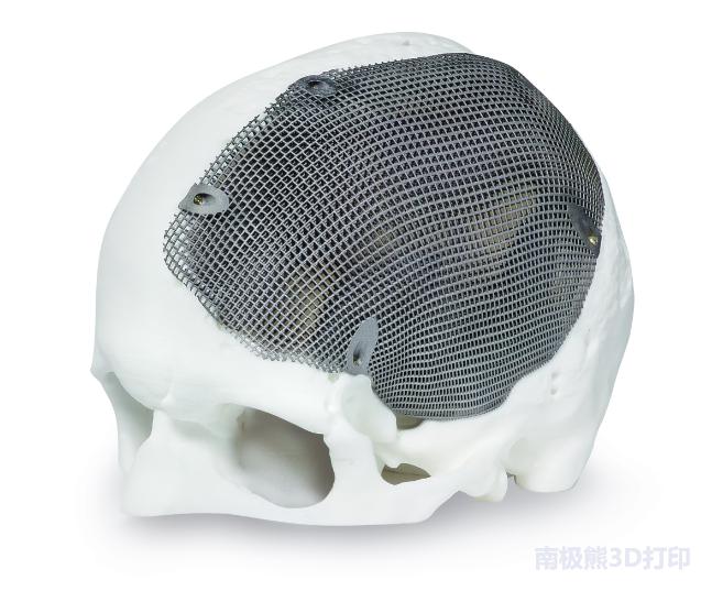 3d打印技术发展图表,精细3d打印技术