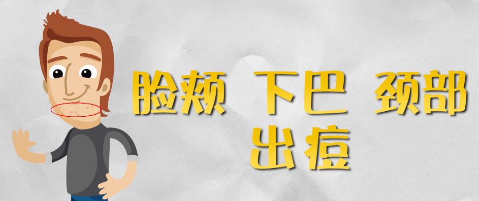 长痘的部位预示身体内部的原因,两侧脸颊长痘是内脏哪里有问题