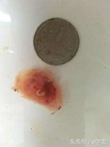 早期怀孕停胎了怎么处理,孕早期停胎会自然流产吗