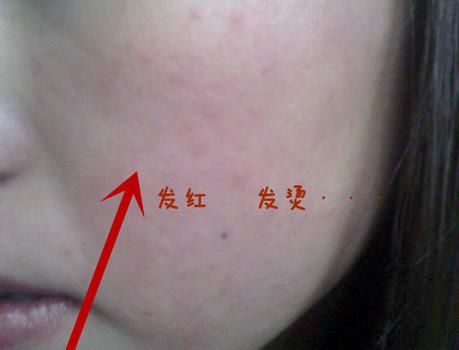 白醋能洗脸吗能去皱纹吗,白醋能洗脸吗能祛斑吗