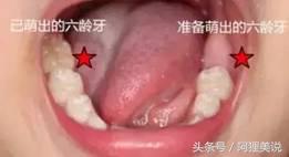 换牙期间怎么做才能让牙齿长整齐,小孩牙齿长得太疏换牙会丑吗