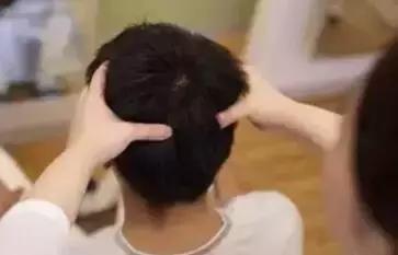 头上长疙瘩有脓包怎么治疗,头上长脓包是什么原因怎么治疗