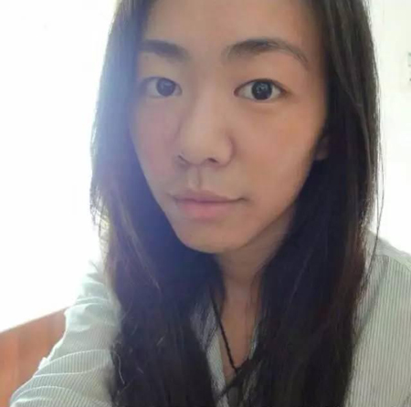 这就是传说中的脱一层皮，隔着屏幕都感觉疼