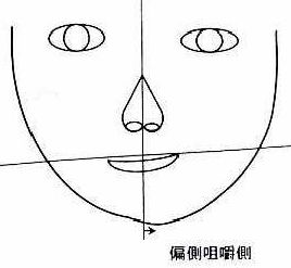 用一边牙齿吃饭脸歪了能恢复吗,长期一边吃饭脸歪