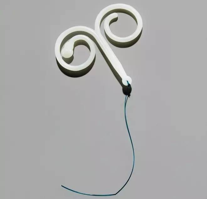 宫内节育器的扭曲历史,宫内节育器移位案例