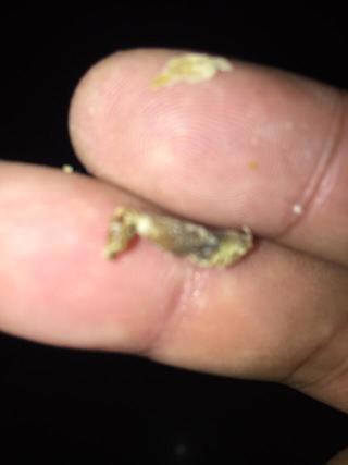 怎样才能挖到这么大块耳屎?恶心!但看着好爽啊!