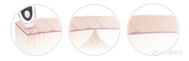 提拉紧致美容仪评测 (紧致提拉美容仪到底有没有用)