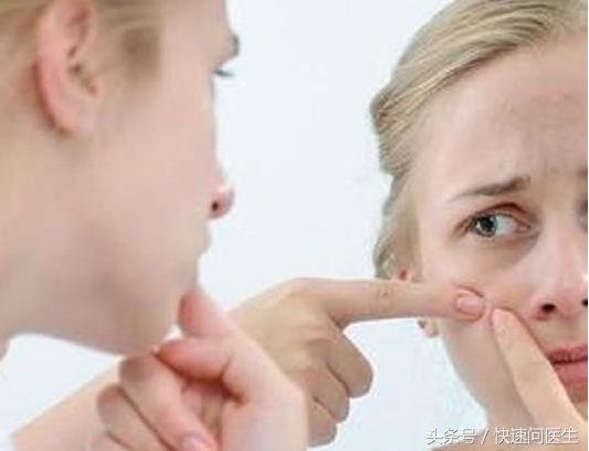 消除痘痘,消除暗疮印