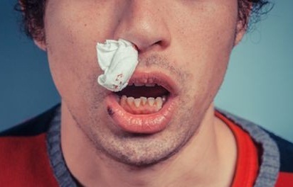 以食代药，把鼻腔流出来的血补回去
