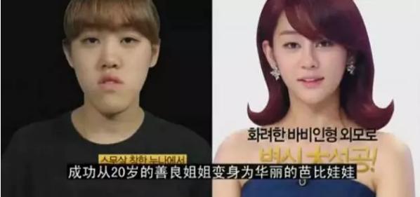 韩国整容手术恢复过程,韩国一个整容的综艺节目
