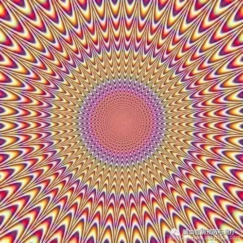 眩晕太可怕,有谁知道眩晕症是怎么回事吗