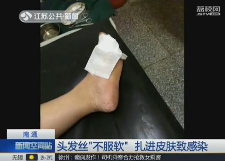 头发被传染奇痒难耐怎么办啊,头发丝不光滑是什么原因