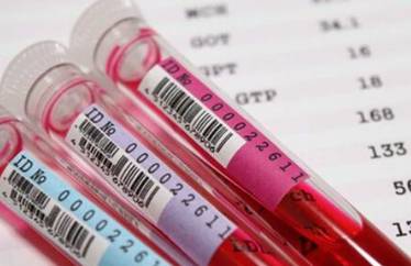 血常规检验单怎么看结果,血常规检验报告单怎么看有问题