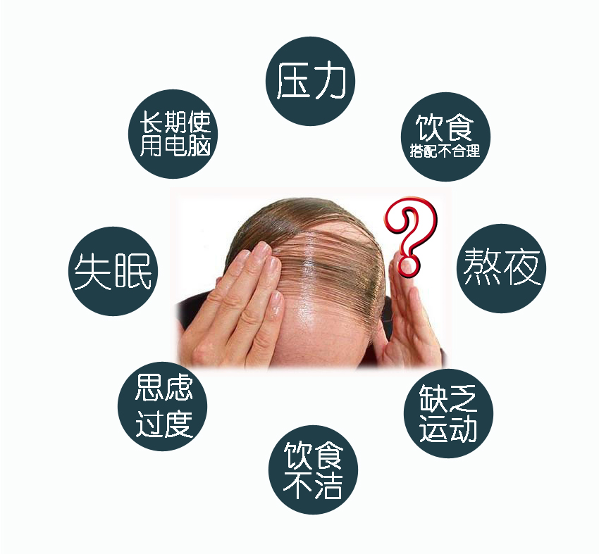 三种药治疗脱发,4种最佳的脱发食疗方法