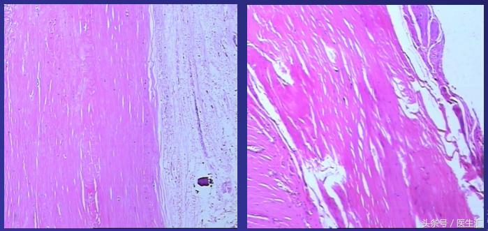 感染会导致腹水吗,腹水感染科