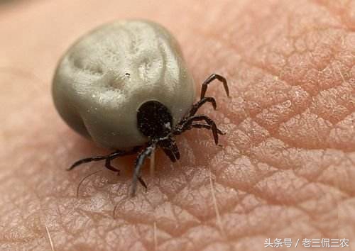 如果脏到长了这个东西，不管是城里还是农村人，都注定讨不到老婆