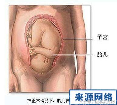 剖腹产女性手术,女的剖腹产手术的全部流程