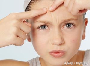成年人脸上长痘痘什么原因,成年人长痘痘是缺乏营养吗