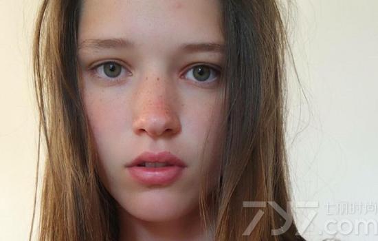 脸上过敏红肿发痒急救,脸上化妆品过敏发红发痒急救妙招
