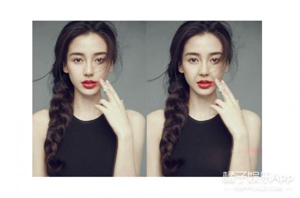 笑容引起的法令纹怎么解决,怎么样的笑容可以改善法令纹