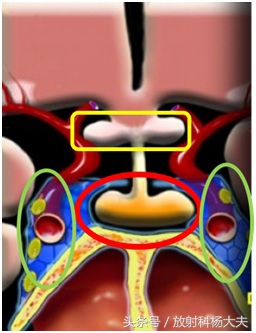 男子性腺功能减退治疗,男子脑内有多个肿瘤