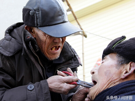 拔牙后凝血功能太差一直流血,拔牙后为什么一直渗血