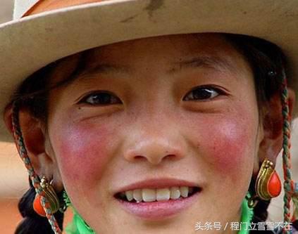 去面部红血丝最有效药,祛面部红血丝最有效的方法