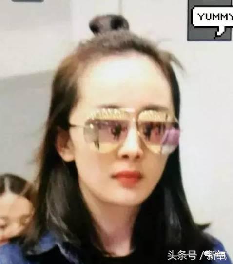 杨幂发际线还会回归吗,杨幂发际线秃到后脑勺