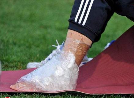 脚踝扭伤皮下有瘀血怎么处理,脚踝扭伤没有及时处理解决方法