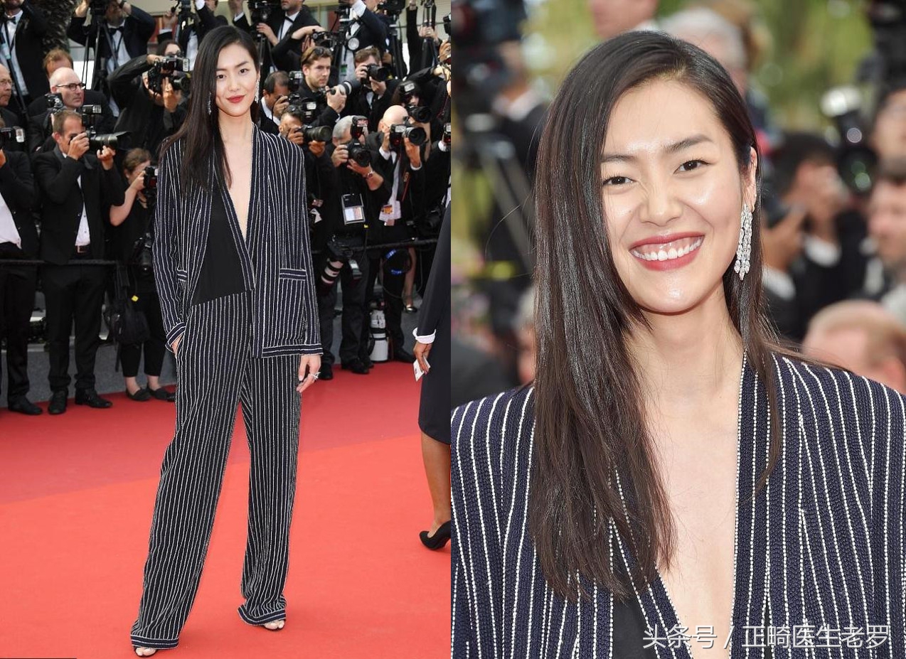 露龈笑矫正危害大吗,露龈笑毁了一辈子