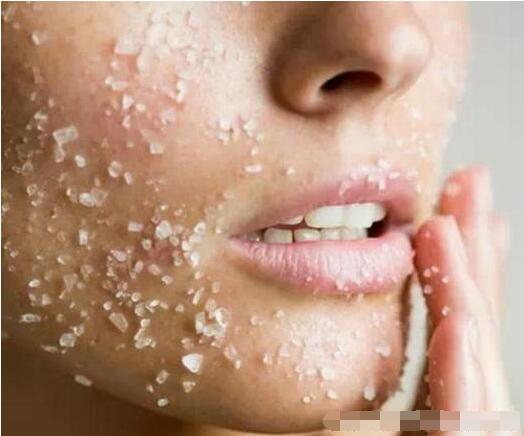 激素脸脸又很红特别干怎么办,激素脸皮肤特别特别干怎么处理