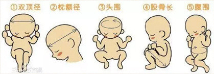 怀孕2个月了做腹部b超看得清楚吗,整个孕期大概做多少次b超