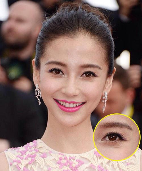 因为爱笑眼角皱纹比较多怎么办,爱笑的女孩有笑纹怎么办