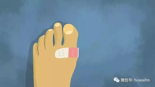 一篇文章看懂你的脚上为什么容易起水泡，起了水泡该怎么办