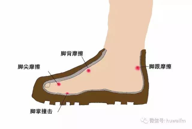 一篇文章看懂你的脚上为什么容易起水泡，起了水泡该怎么办