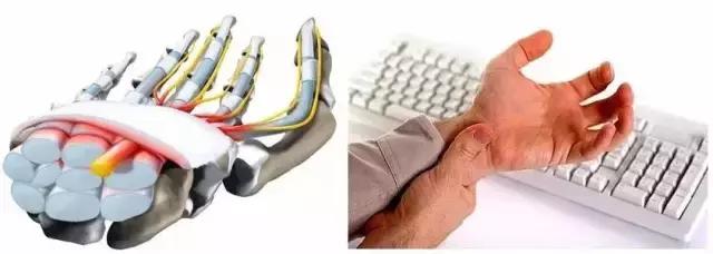 康复训练时手腕手指肿痛怎么缓解,手腕疼的康复练习