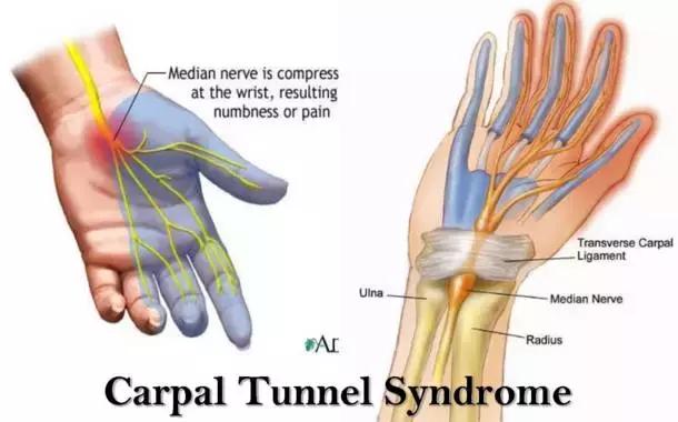 康复训练时手腕手指肿痛怎么缓解,手腕疼的康复练习