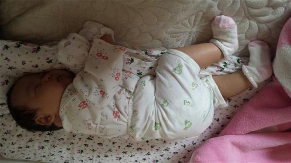 婴儿头型睡成了偏舟形怎么办,一岁宝宝头型睡偏了还能补救吗