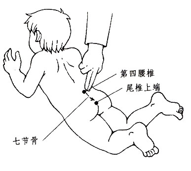 小儿虚证便秘推拿方法,小儿便秘推拿手法