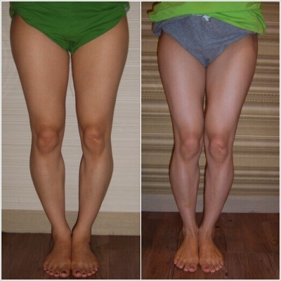 大粗腿该怎么穿,如何改善腿粗小妙招