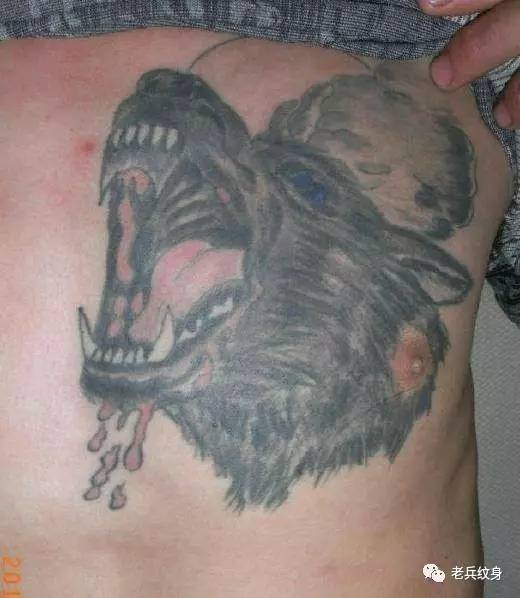 洗纹身不留疤用什么仪器好,有没有什么办法洗纹身不留疤