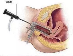 陪闺蜜看妇科，顺道“长”了知识！