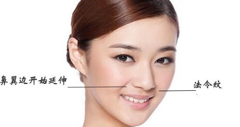 有了法令纹怎么消除,有了法令纹怎么消除的好方法