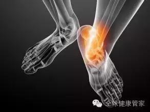 揭秘仅关注嘌呤的痛风饮食靠谱吗,痛风罪魁祸首高嘌呤食物