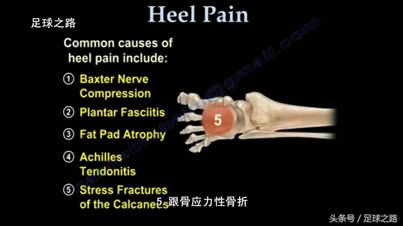 足跟痛最常见病因,足跟痛警惕四种疾病