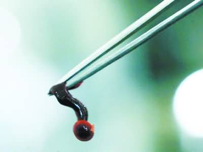 养殖蚂蟥有什么风险,变害为利造福人民