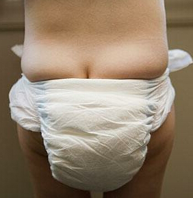 22岁尿尿分叉是啥原因,小姑娘尿分叉是什么原因