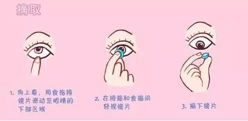 隐形眼镜科普小知识,关于隐形眼镜的基本知识和讲解